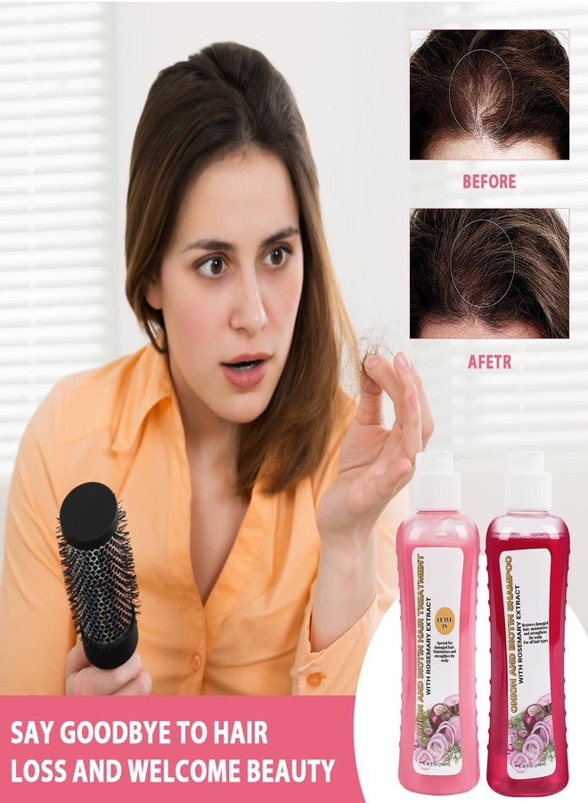 TIMLIFE Onion And Biotin Hair Treatment 2 * 8.38 fl Oz, Onion Biotin and Rosemary Shampoo and Treatment Set, Silicone Free Shampoo and Treatment for All Hair Types Conditioner Hair Care - Image 2